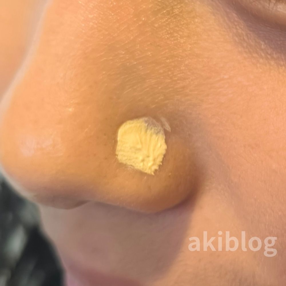 アクセーヌ ニキビコンシーラーの色とテクスチャー